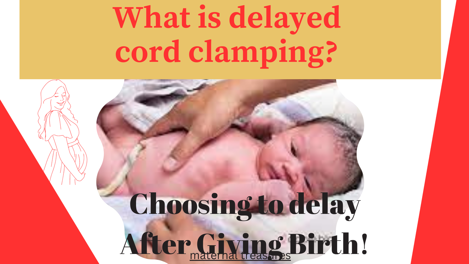 DELAYED CORD CLAMPING