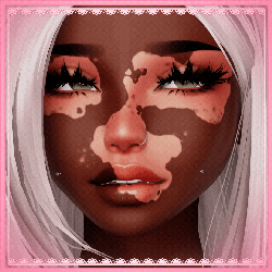 FREE Vitiligo Pack by Nessy!